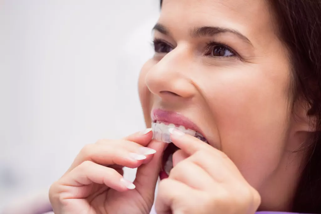Las férulas dentales y sus múltiples usos